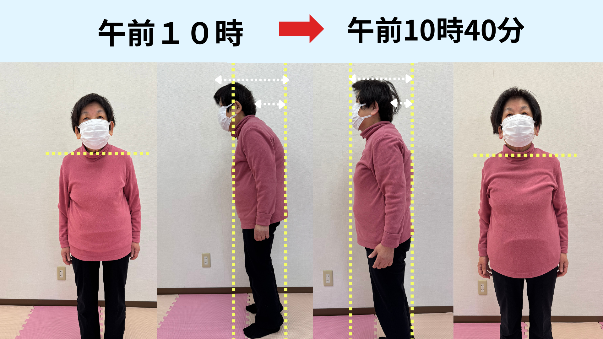 事例1